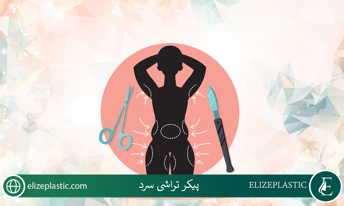 پیکر تراشی سرد